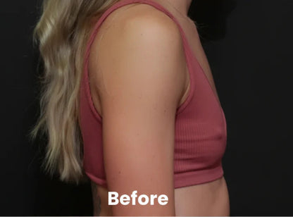 EscoteLift – Parches reafirmantes para el pecho